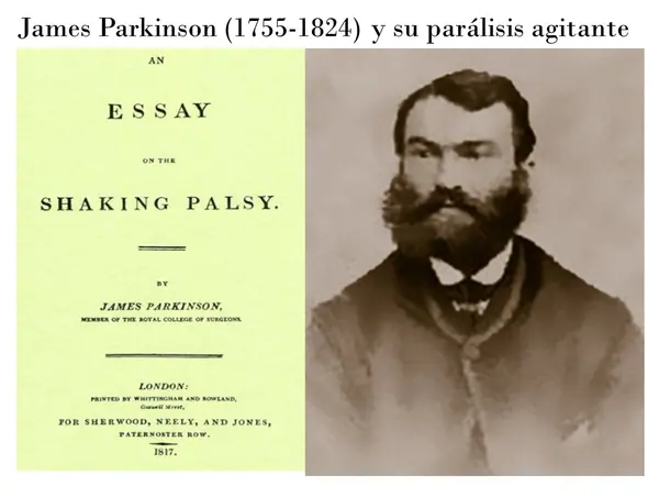 James Parkinson